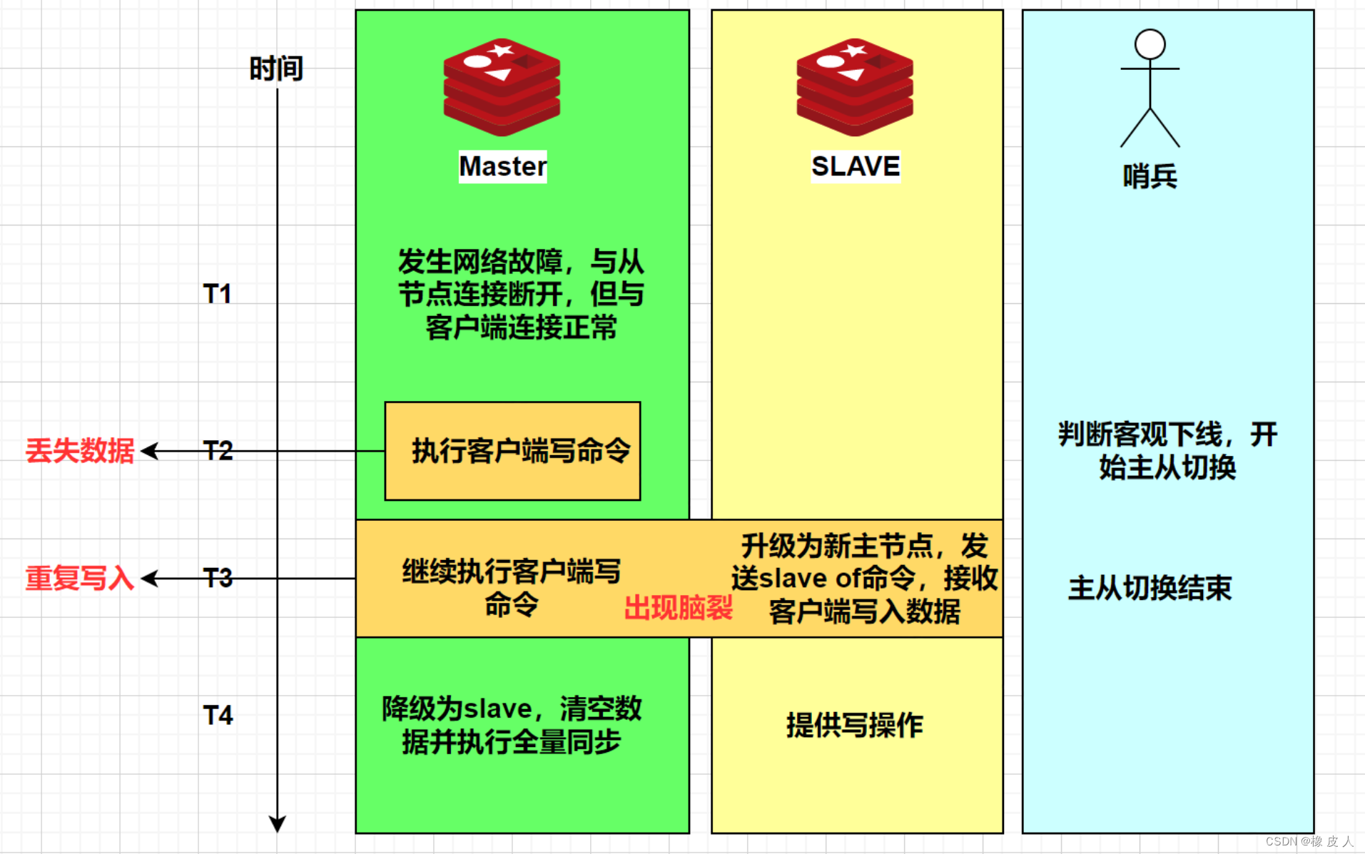 橡 皮 人：脑裂问题